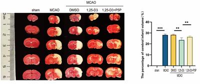 1α,25-Dihydroxyvitamin D3 Promotes Angiogenesis After Cerebral Ischemia Injury in Rats by Upregulating the TGF-β/Smad2/3 Signaling Pathway